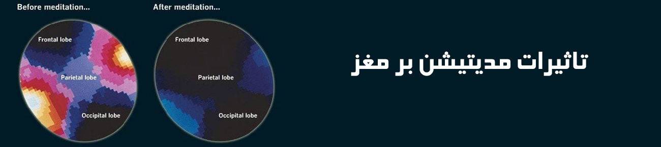 تاثیرات مراقبه بر مغز